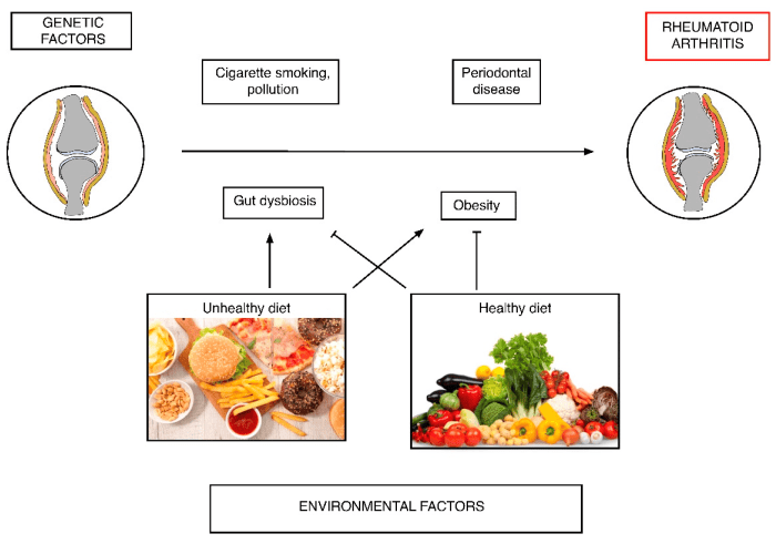 Ernährungs docs rheuma kinder